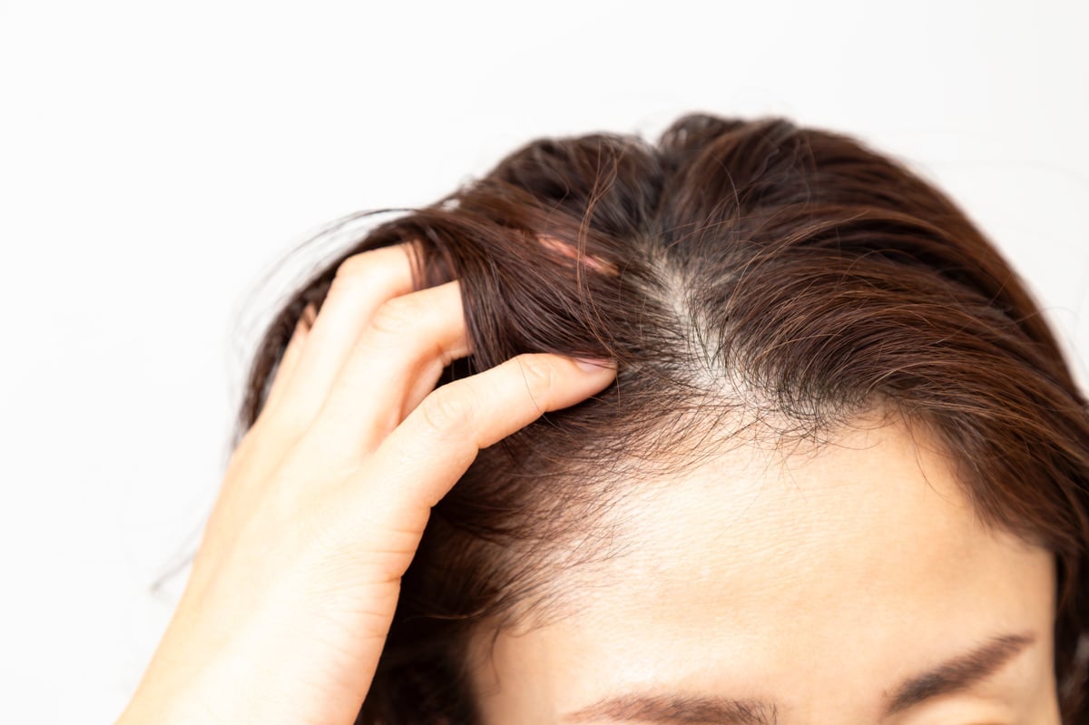 A middle-aged woman who cares about her hair — female density SMP candidate