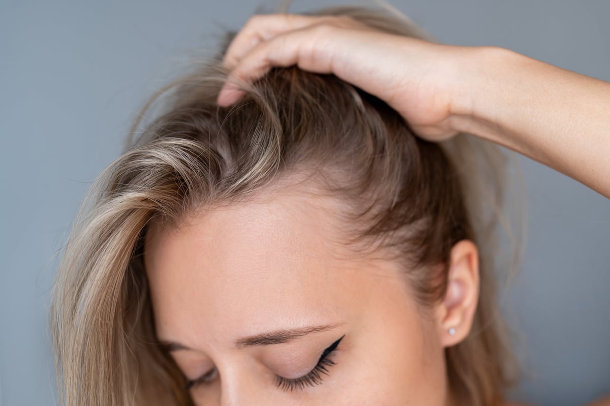 Close-up of woman lifting her hair to reveal hairline and scalp — female density SMP candidate