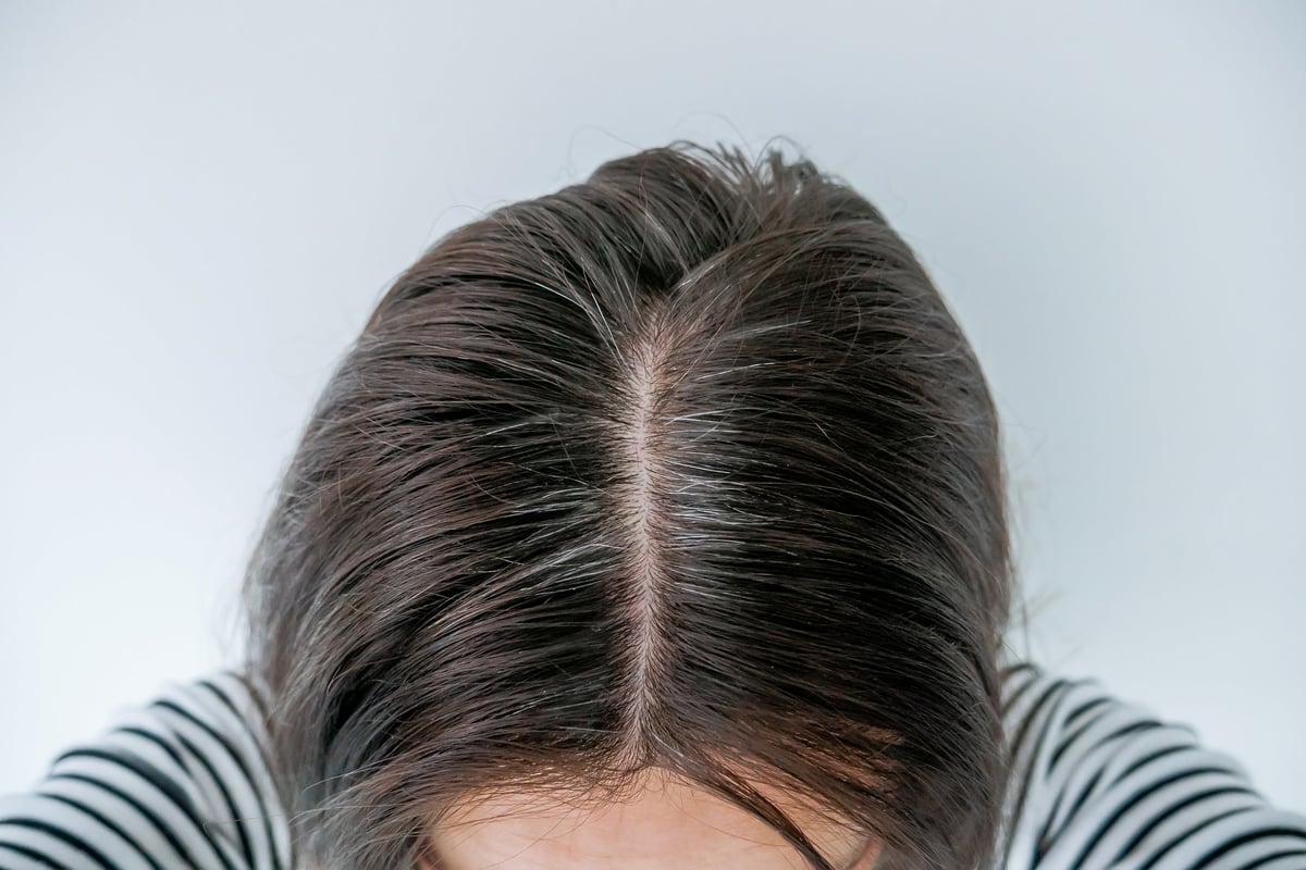 Close-up of woman's scalp with gray hair roots and visible thinning — density SMP candidate