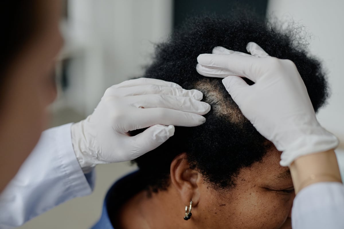 Middle aged Black woman sitting while healthcare professional wearing gloves examining scalp for dermatological condition during medical consultation in clinical setting